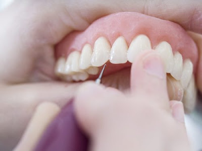 Phân vân làm răng sứ có hại không khi thực hiện 2