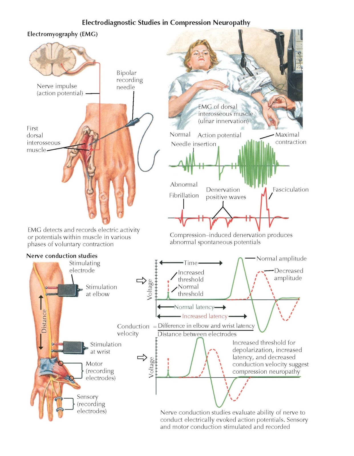 Electromyography And Conduction Velocity Studies Pediagenosis