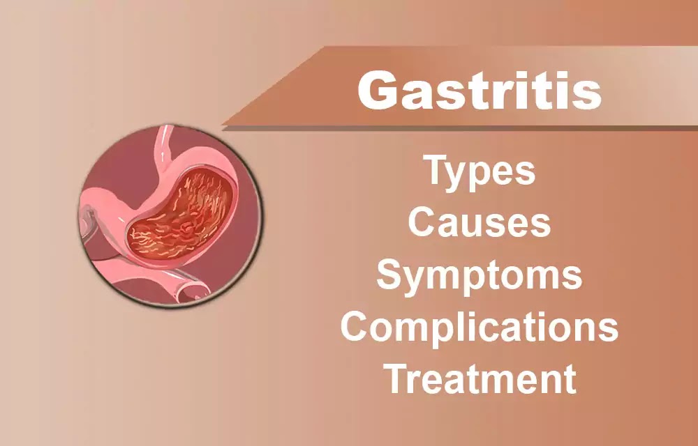 What is gastritis and its causes symptoms complications treatment
