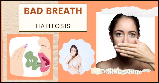 BAD BREATH - HALITOSIS