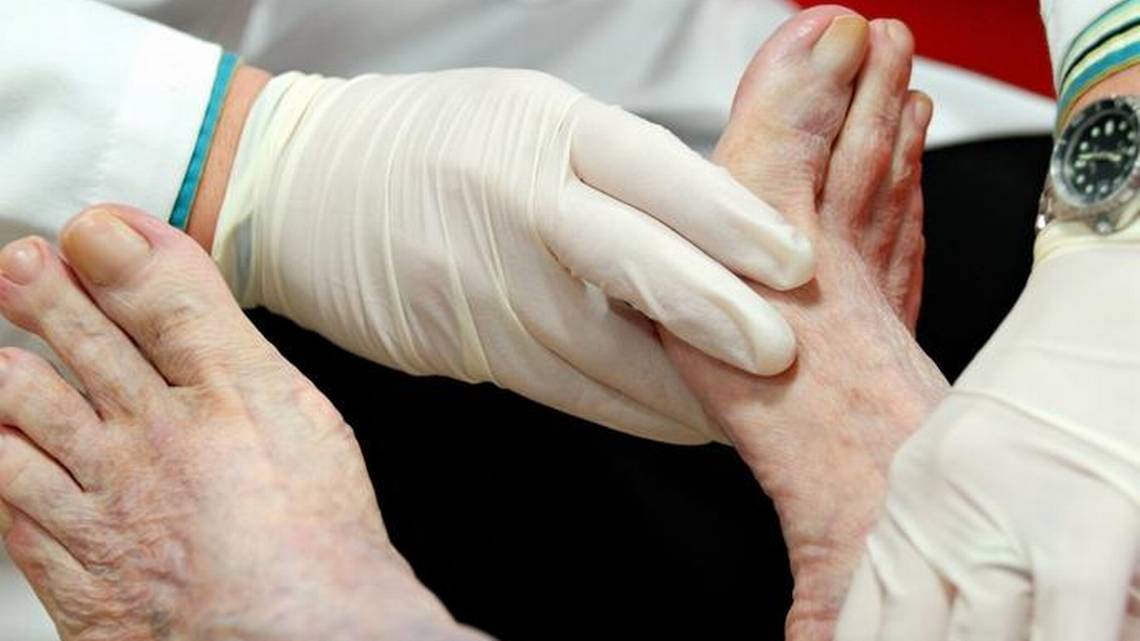 Pie Diabético con Angiopatía Examen Vascular y Cuando Derivar a