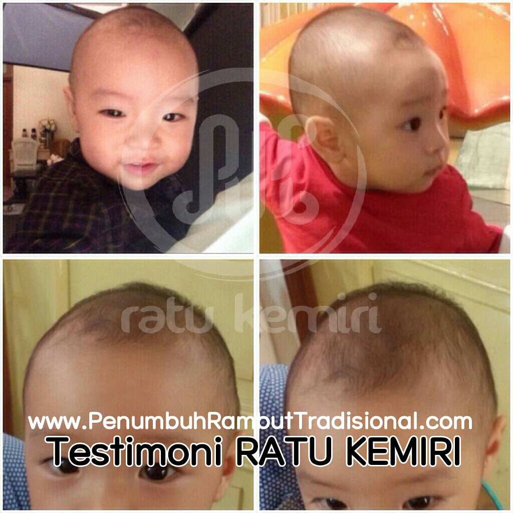 Agen Minyak Kemiri Murni Ratu Kemiri Jual Minyak Kemiri Murni Agen Minyak Kemiri Murni Ratu Kemiri Jual Minyak Kemiri Murni