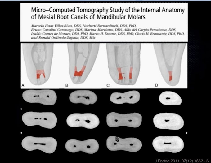 ENDODONCIA: Diagnóstico Sustentado en Tomografía - C.D. María de los Ángeles Vázquez