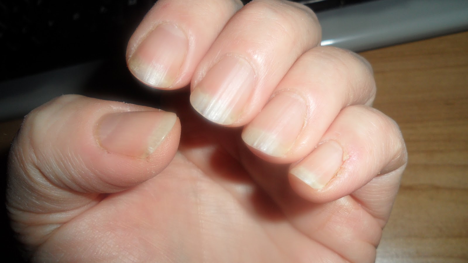 Beauty Blog by Lisa TIPS from head to toe! From acrylic damaged