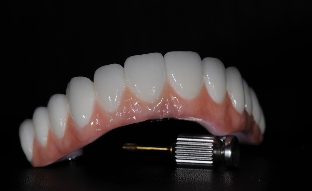 Advantages and Disadvantages of Dentures