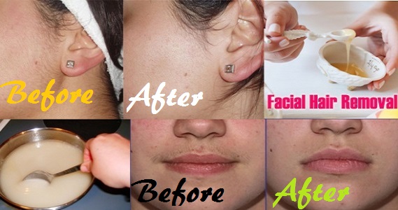 Vi Natural Way To Remove Facial Hair At Home