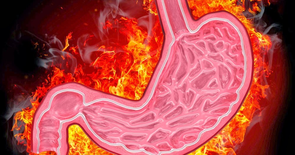 Obat Herbal Asam Lambung Tinggi