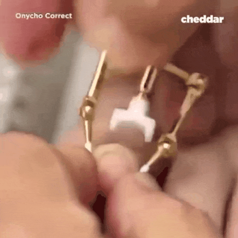 11.gif
