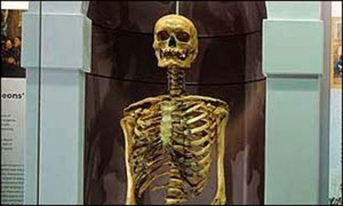 The skeleton of Jonathan Wild at the Royal College of Surgeons