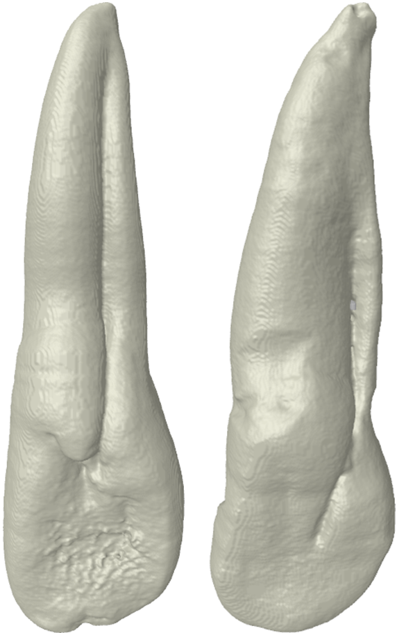 The Root Canal Anatomy Project Radicular Groove Maxillary Incisors