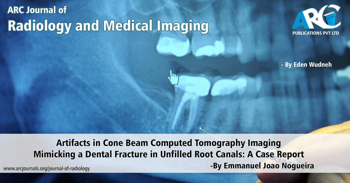 Artifacts in Cone Beam Computed Tomography Imaging Mimicking a Dental