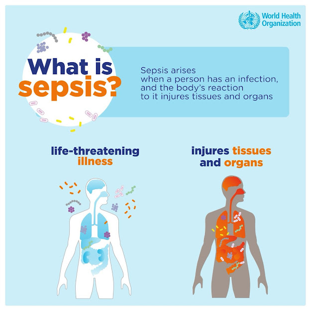 National Cancer Society of Malaysia, Penang Branch What Is Sepsis?
