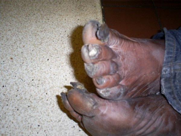 [Image: ugly-feet-2.jpg]
