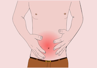 Abdominal pain