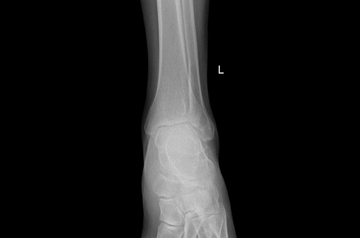 Dr Jayant Arora, Knee replacement Surgeon and Sports Injury Specialist