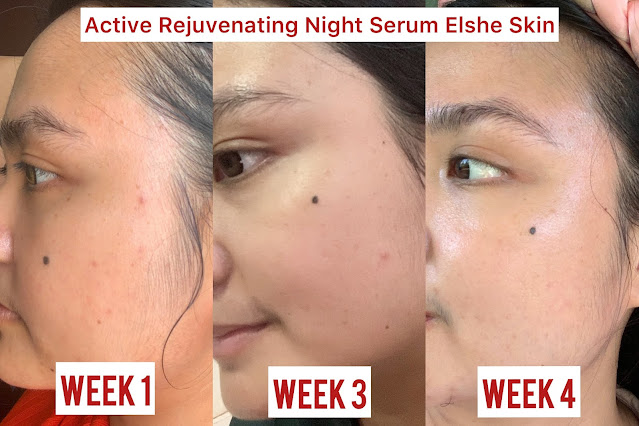 ELSHE SKIN ACTIVE REJUVENATING NIGHT SERUM REVIEW ELSHE SKIN ACTIVE REJUVENATING NIGHT SERUM REVIEW