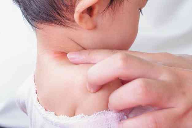 Recognize the factors that cause allergies in babies
