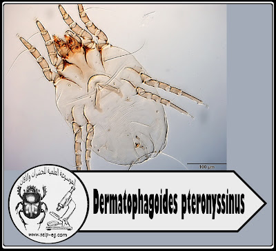عث غبار المنزل House dust mites - Dermatophagoides pteronyssinus