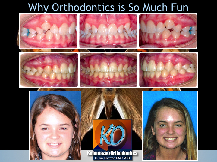 Embracing Innovative Orthodontics Portage, Kalamazoo, Paw Paw, MI