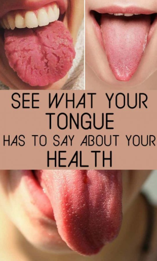 Find Out What Your Tongue Is Trying To Tell You