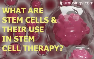 WHAT ARE STEM CELLS AND THEIR USE IN STEM CELL THERAPY? (#biochemistry)(#ipumusings)(#genetics)(#biotechnology)