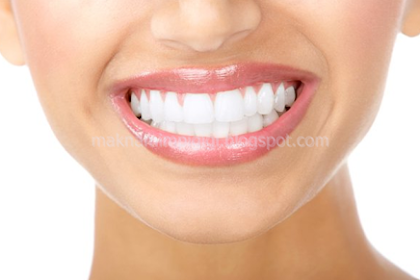 Mimpi Gigi Gingsul Atas Copot - Lektur Indo