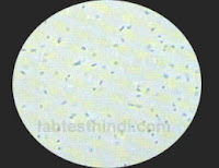 Urine Microscopic - Bacteris