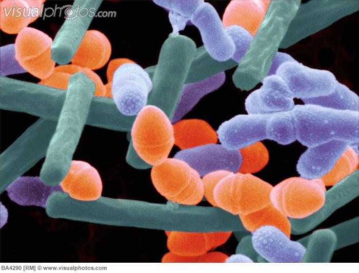 Gambar bakteri berkembang biak pada yogurt