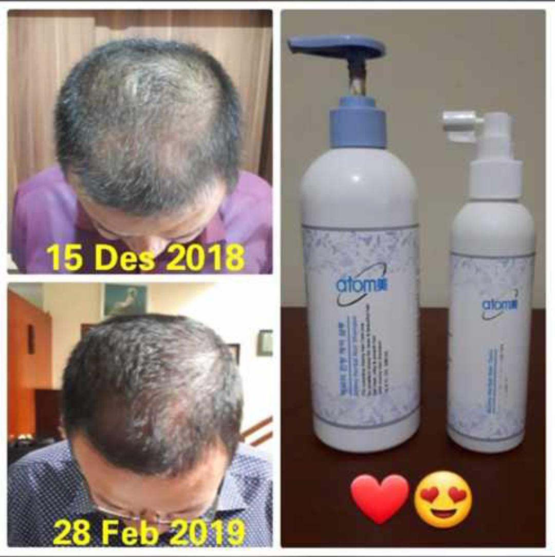 Atomy Herbal shampoo and herbal hair tonic for hair loss solutions