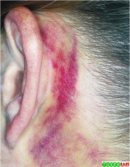 [Emergency] Atlas of Head and Facial trauma | Free Medical Atlas