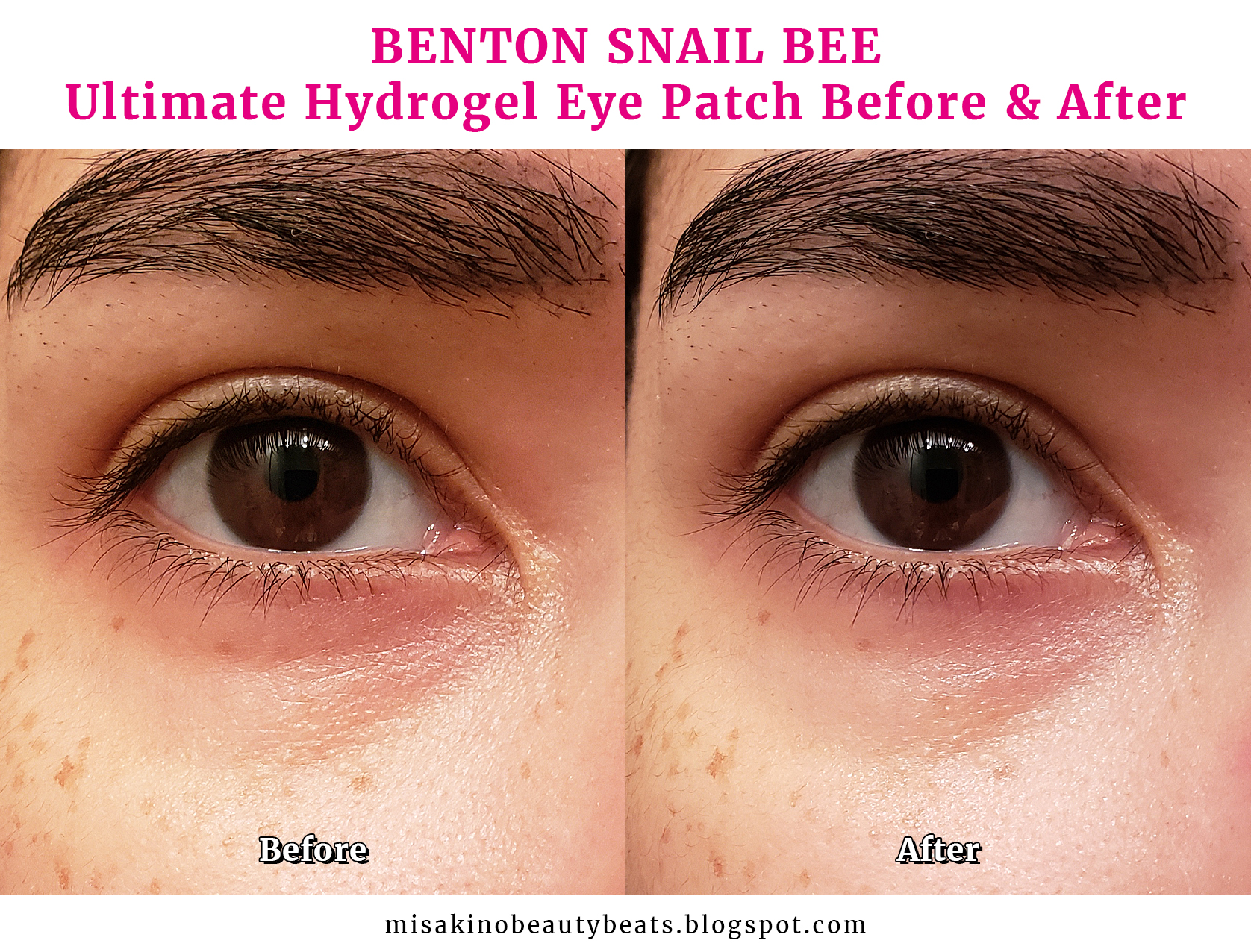 Review Benton Snail Bee Ultimate Hydrogel Eye Patch MISAKINO