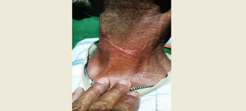 PL proibindo uso de cerol, linha chilena e similares para soltar pipa na cidade de Patos-PB