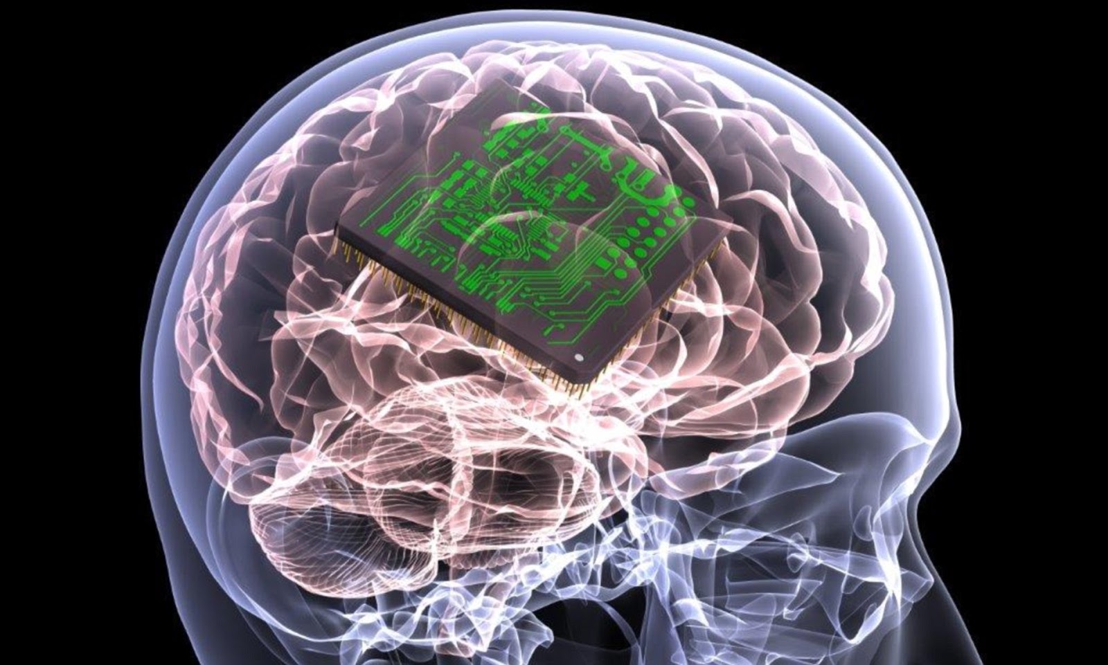 The implantation of microchips in the human brain help paralyzed