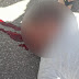 Jovem fica ferido após sofrer acidente de moto no Núcleo Habitacional II em Sousa