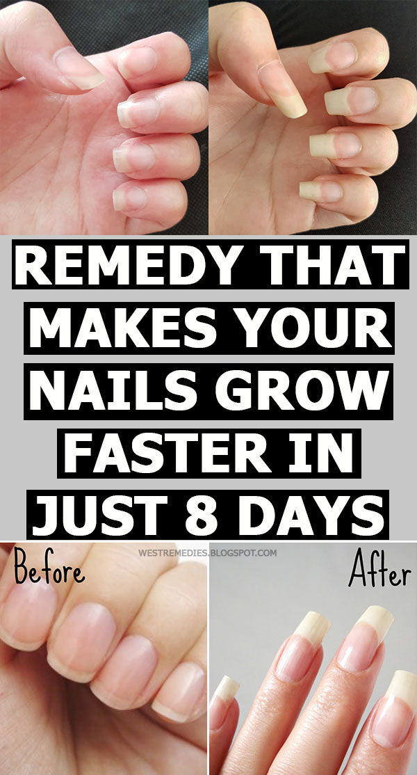 Remedy That Makes Your Nails Grow Faster in Just 8 Days
