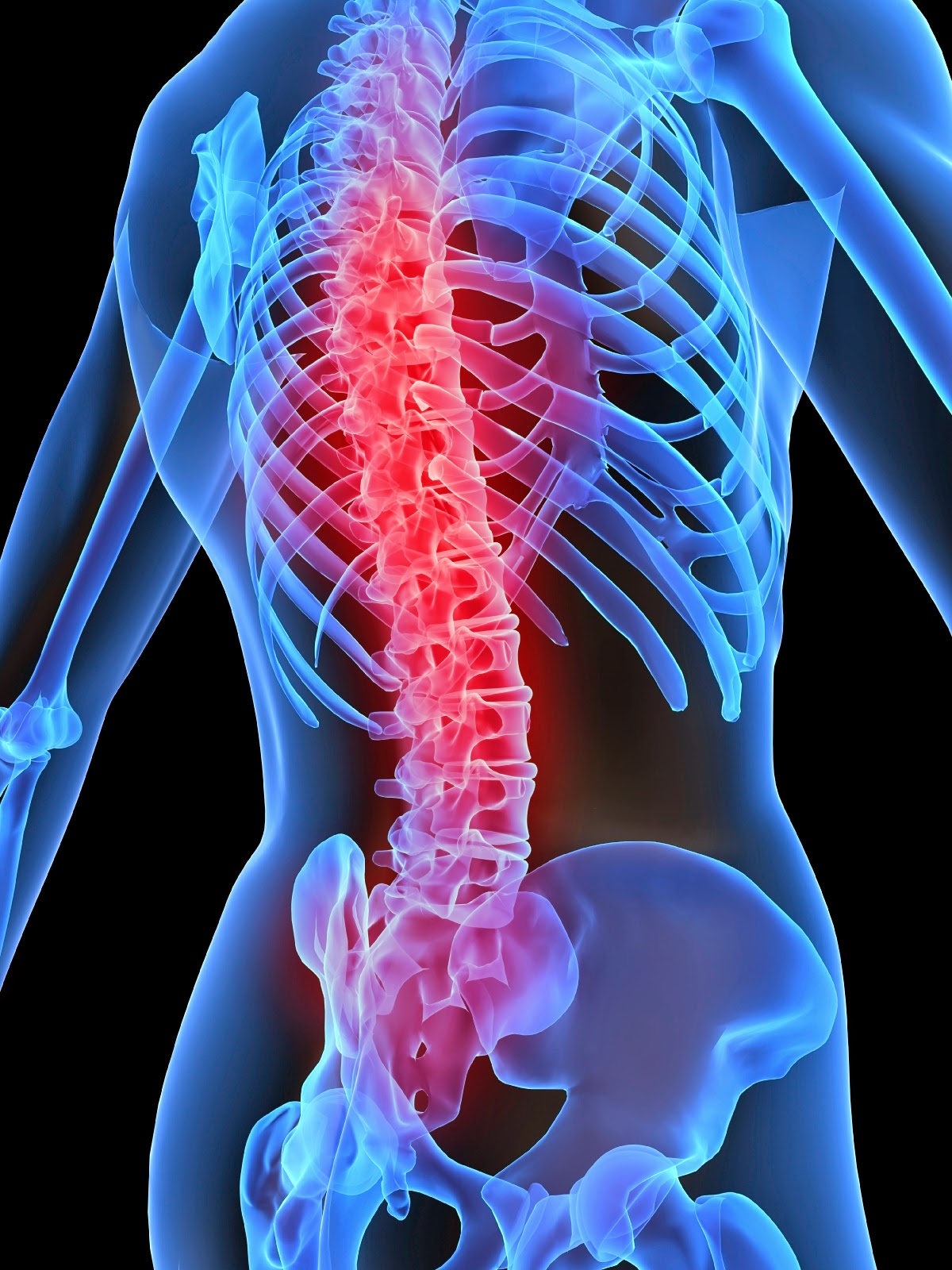 SUPPLEMENTS FOR HEALTHS: Bahaya Penyakit Osteoporosis yang Tidak Kita