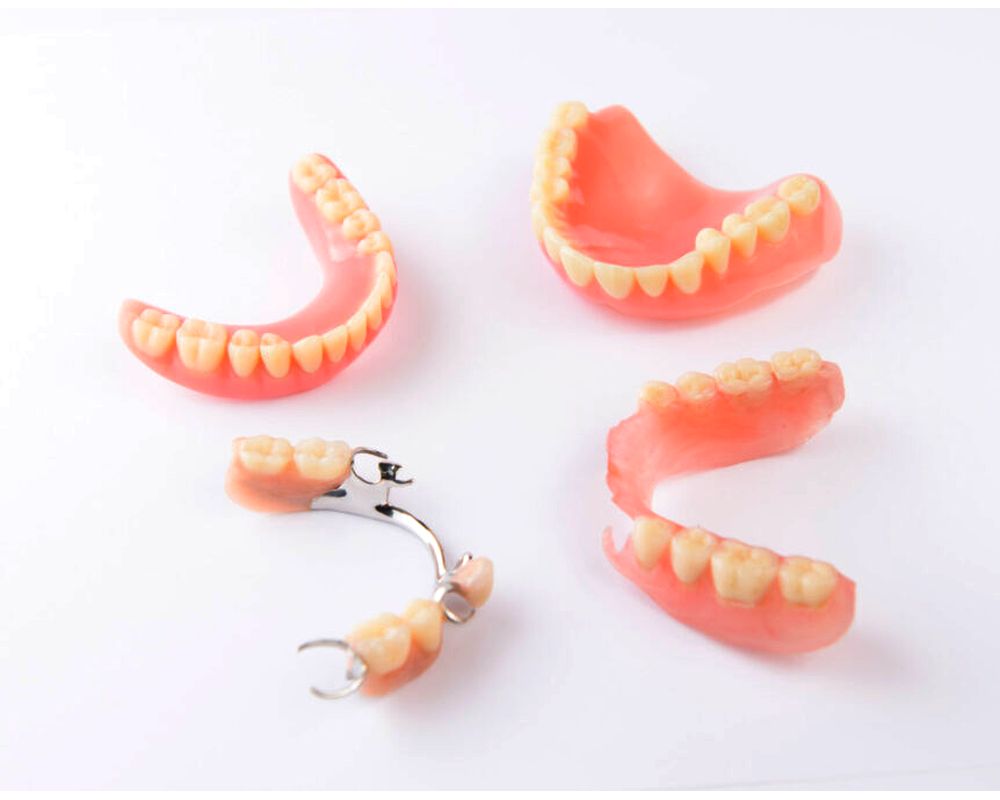 Prótesis Dental Removible. Todo lo que debes conocer Directorio