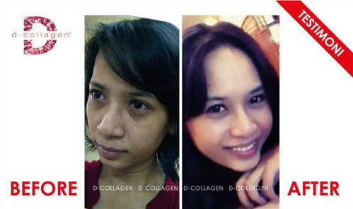 Produk Kecantikan & Kesihatan Wanita dan Lelaki: D-COLLAGEN PRODUK ANTI