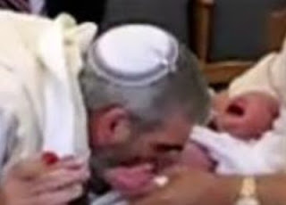 Ritual judaico de circuncisão