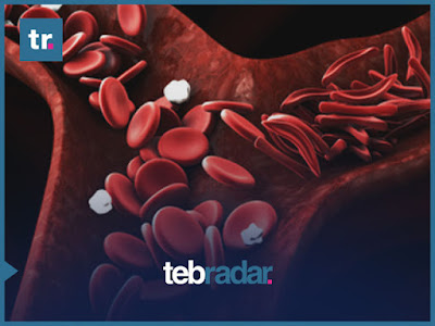 9 تجارب تساعد على خفض نسبة الكولسترول بسرعة في أسبوع