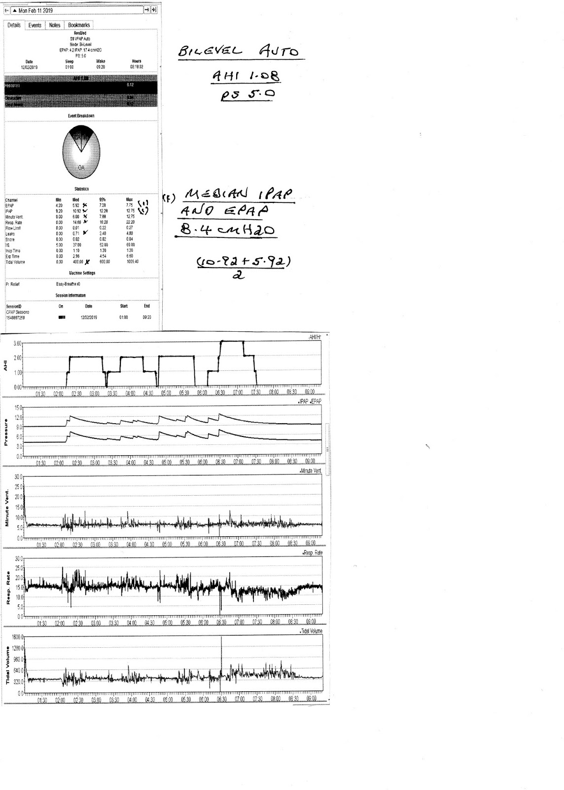 CPAP Health Issues Different Bilevel Settings Example