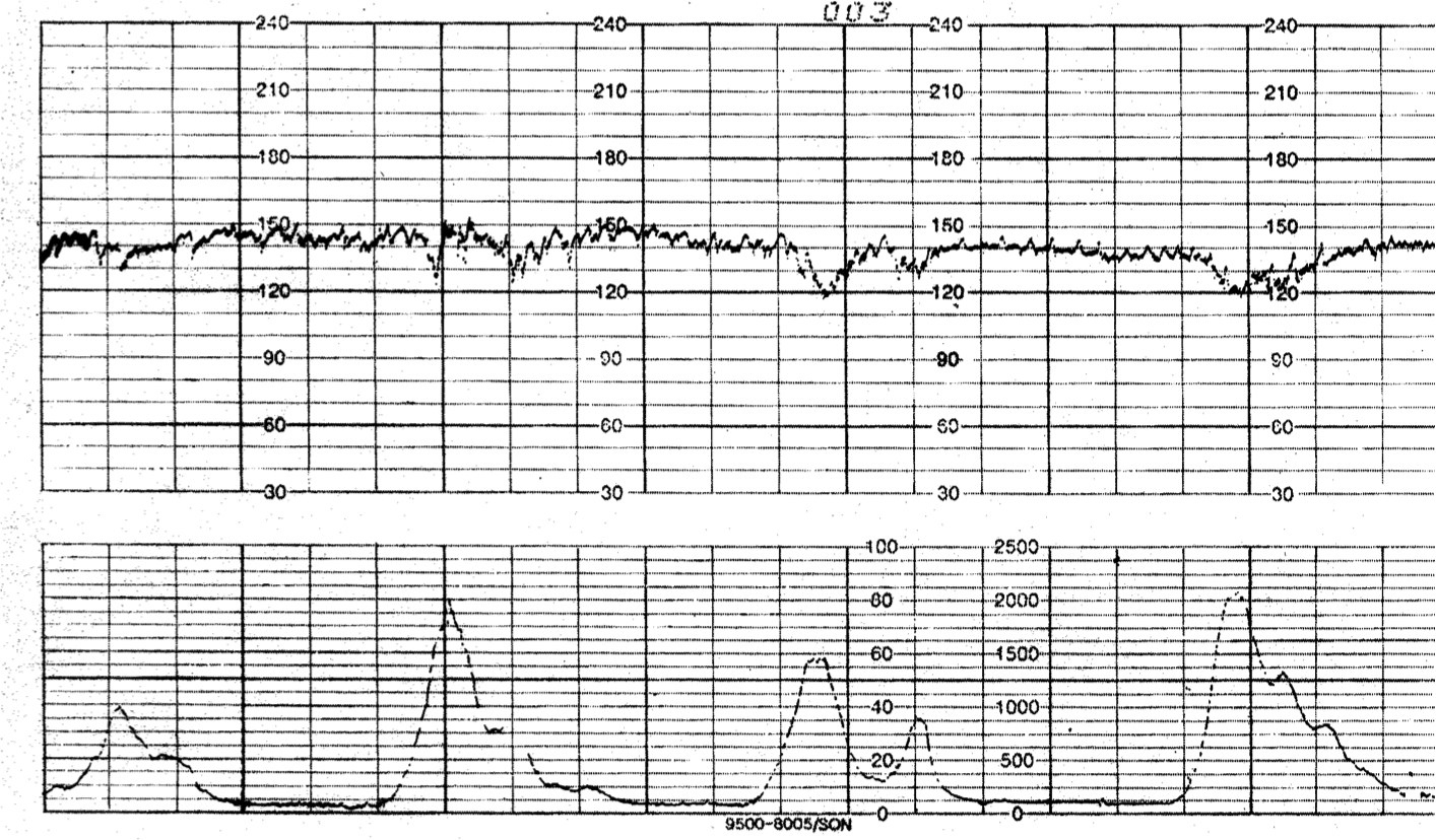 contractions 12 minutes apart contractions 12 minutes apart