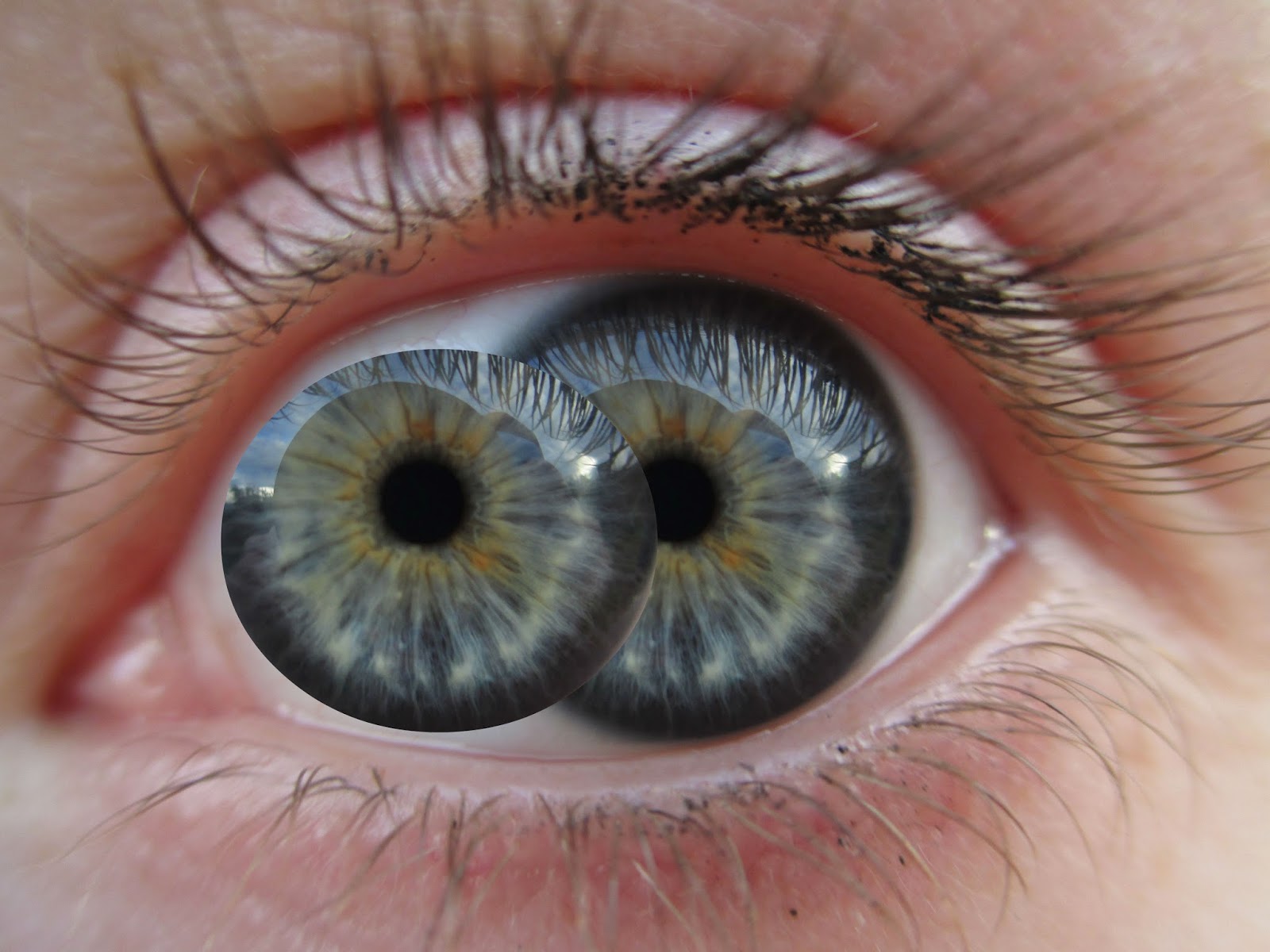 Поликория радужной оболочки. Глаз с несколькими зрачками. Pupula duplex двойной зрачок. В каждом глазу по два зрачка. В каждом глазу по два зрачка.