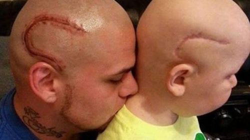 Bukti Kasih Sayang Ayah, Orang Tua Ini Membuat Gambar Tatto Yang Mirip Bekas Luka Operasi Tumor Otak Anaknya Bukti Kasih Sayang Ayah, Orang Tua Ini Membuat Gambar Tatto Yang Mirip Bekas Luka Operasi Tumor Otak Anaknya