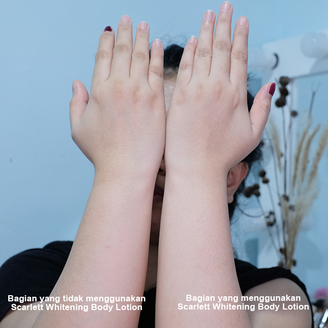 Review Scarlett Whitening, Beneran Bisa Bikin Putih? — APRIJANTI