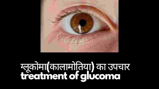 ग्लूकोमा (कालामोतिया) के लक्षण व उपचार - Glaucoma symtoms and treatment in hindi