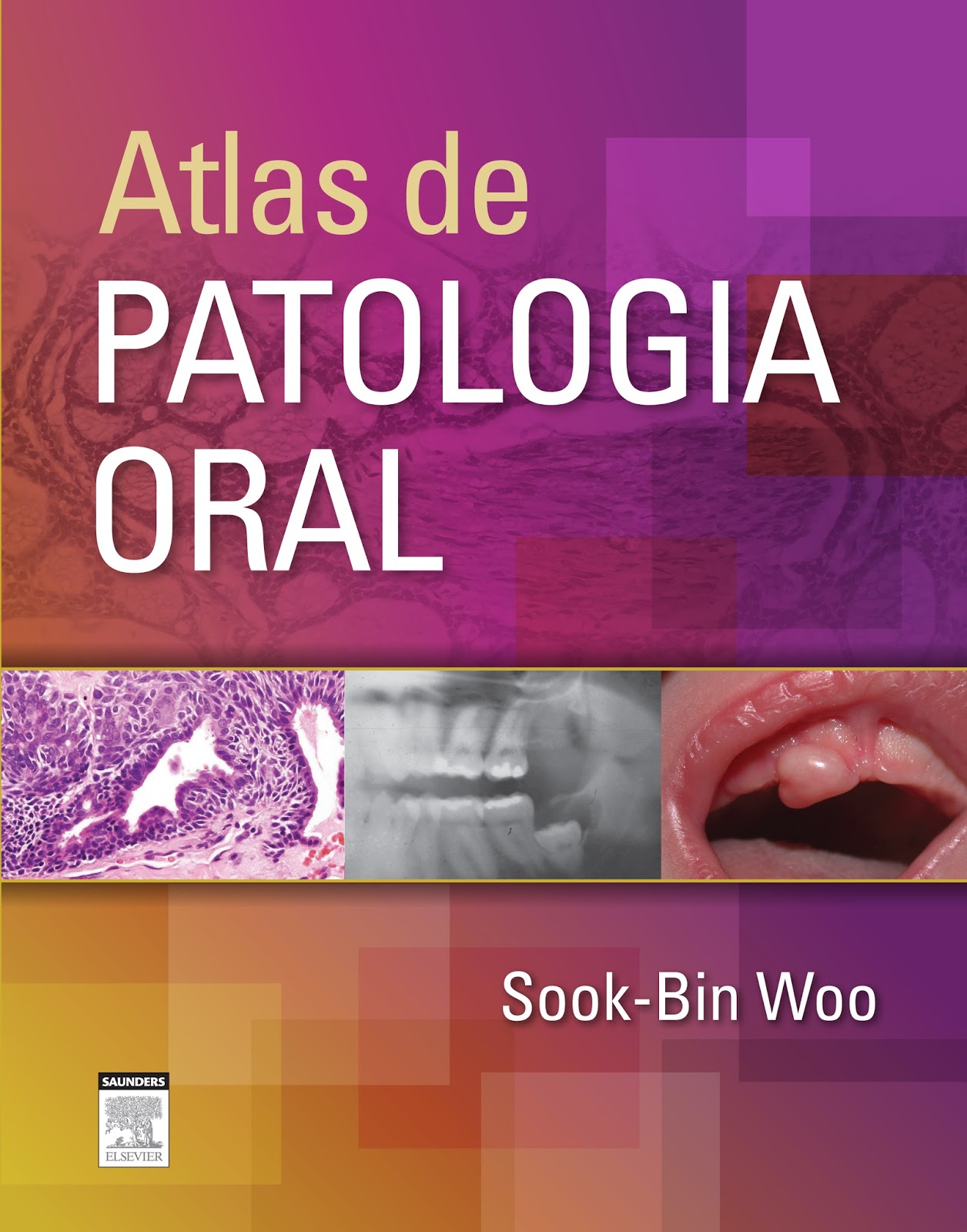Cirurgia e Traumatologia BucoMaxiloFacial: Altas de