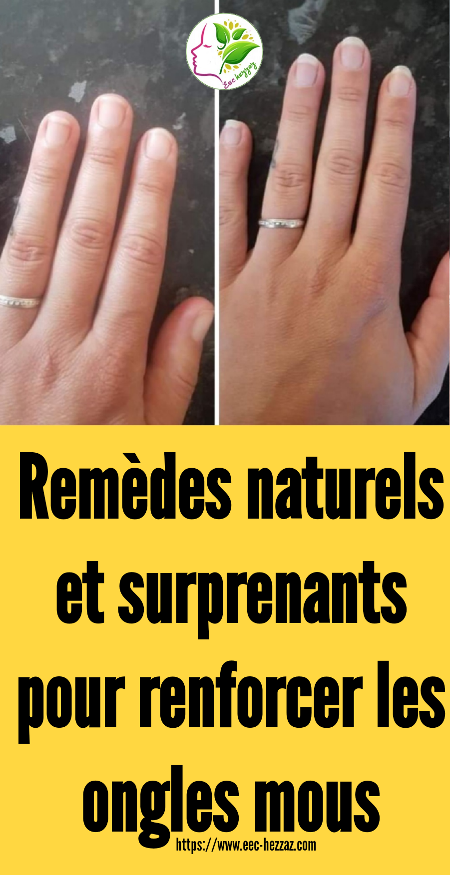 Remèdes naturels et surprenants pour renforcer les ongles mous