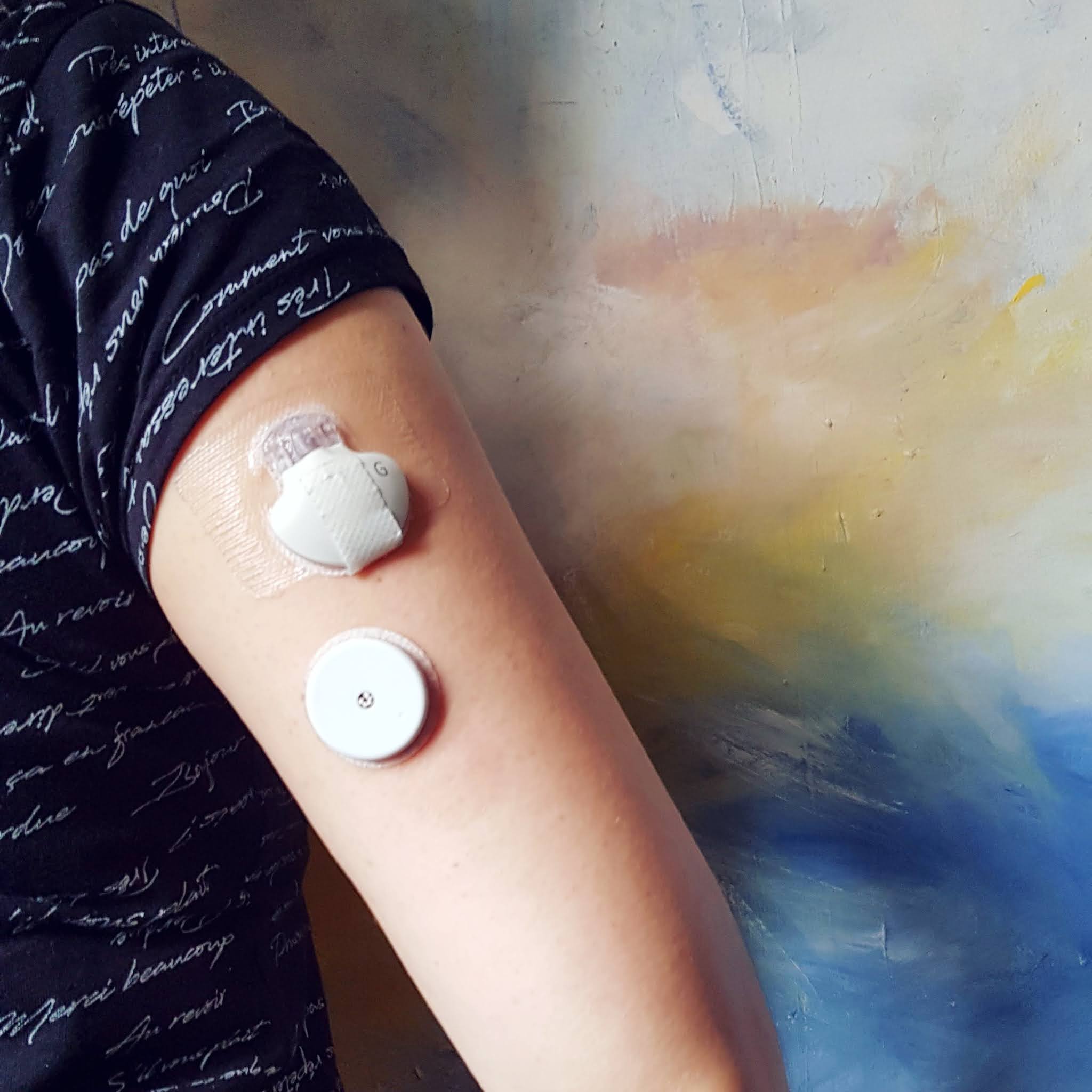 Moje doświadczenie z sensorami FreeStyle Libre, Medtronic Enlite i Dexcom G5