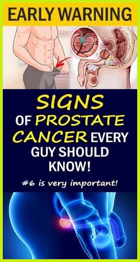 12 Early Warning Signs Of Prostate Cancer That Every Guy Needs To Know Do Not Ignore